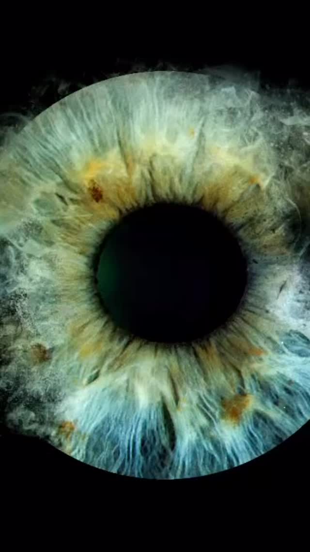#eyes #uniklinik Homburg #iris #thx for the Photo #organspende